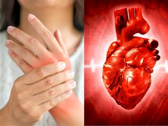Từ biến chứng thần kinh đến hủy hoại tim mạch, đây là 5 tác động xấu của viêm khớp dạng thấp sẽ ăn mòn cơ thể