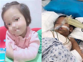 Quặn lòng trước những hình ảnh 'thập tử nhất sinh' của bé gái 3 tuổi bị đóng 9 chiếc đinh vào đầu