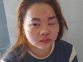 Cô giáo mầm non ở Đắk Lắk bị chồng đánh, phải nhập viện cấp cứu