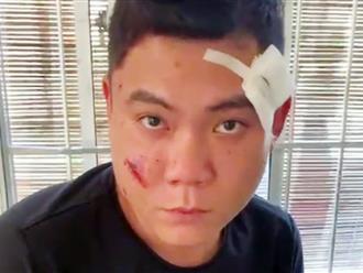 Khánh Hoà: 'Con rể hờ' nổ súng vào gia đình vợ khiến 1 người trúng đạn