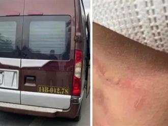 Lời khai của tài xế xe khách ở Quảng Ninh bị tố hành hung, bỏ giữa cao tốc