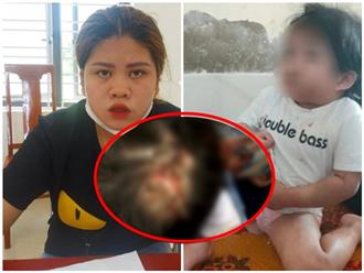 Phẫn nộ trước bé gái 4 tuổi ở Hà Tĩnh bị dì ruột dùng cán chổi, móc áo đánh đập trong 3 ngày: Bầm tím khắp người, vùng mặt sưng tấy, đầu rỉ máu