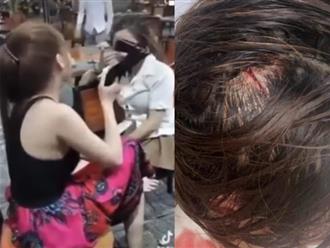 Thiếu nữ 16 tuổi bị chủ tiệm spa đánh bầm mắt, cắt tóc rồi đăng lên mạng