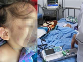 Tình trạng sức khỏe của bé gái 2 tuổi bị 2 bảo mẫu đánh dẫn đến dập phổi, chấn thương sọ não