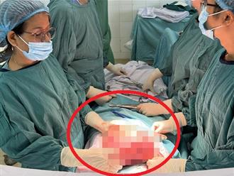 Bệnh viện Đa khoa Quảng Nam vừa phẫu thuật thành công cho bệnh nhân 58 tuổi mang u xơ tử cung 7,3kg