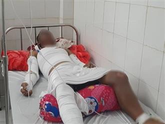 Nổ hầm máy ghe lưới ghẹ ở Cà Mau, 3 người bỏng nặng nhập viện cấp cứu