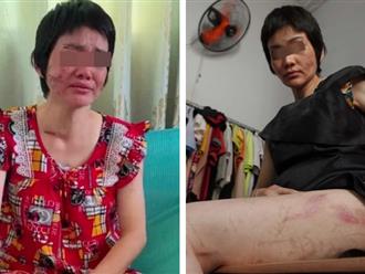Vụ bạo hành vợ mang bầu ở Hải Dương: Hình phạt nào cho kẻ vũ phu?