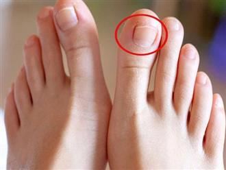 3 dấu hiệu nhỏ trên bàn chân chứng tỏ bạn là người có sức khỏe tốt, sống lâu trăm tuổi