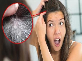 7 yếu tố âm thầm khiến người trẻ tóc bạc sớm