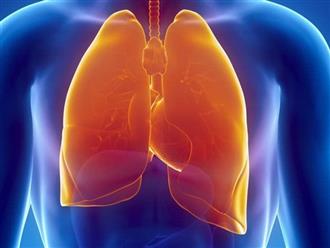 Bác sĩ bệnh viện Phổi Trung ương: Những loại thực phẩm làm giảm nhiễm độc phổi