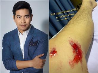 Chồng cũ Ngọc Lan - diễn viên Thanh Bình khiến fan lo lắng khi bị tai nạn giao thông: ‘Nát người banh chiếc xe’