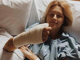 Cô gái 20 tuổi bị ung thư da vì thường xuyên cắn móng tay