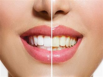 Đánh răng mỗi ngày nhưng răng ngày càng vàng ố xỉn màu có thể do 5 sai lầm ai cũng dễ mắc phải sau