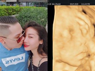 HOT: Hằng BingBoong bất ngờ khoe ảnh siêu âm, xác nhận mang thai con đầu lòng với bạn trai người Pháp gốc Việt