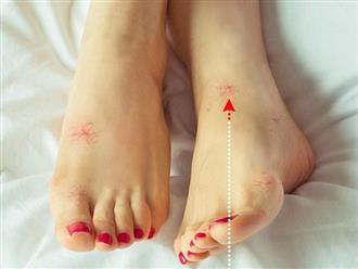 Nhìn dấu hiệu bất thường ở đôi chân cũng có thể đoán biết cơ thể đang gặp phải vấn đề sức khỏe gì