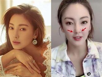 ‘Song Hye Kyo Trung Quốc’ - Trương Vũ Kỳ lộ biến chứng phẫu thuật thẩm mỹ khiến nhiều người ‘phát hoảng’