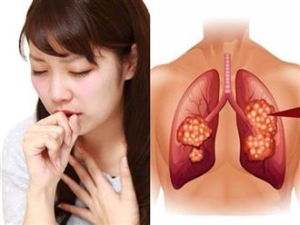 Tưởng cảm cúm thông thường hóa ra lại là dấu hiệu của bệnh ung thư phổi