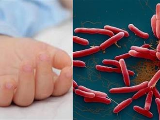 Bé 2 tuổi ở Đắk Lắk tử vong do nhiễm vi khuẩn 'ăn thịt người'