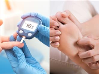 Dấu hiệu ở chân cho thấy lượng đường trong máu tăng vọt nguy hại đến cơ thể 