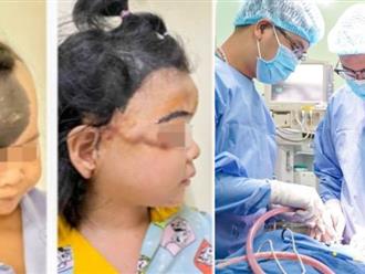 Hành trình 3 năm gian nan tìm lại gương mặt xinh xắn cho bé gái có khối u hắc tố khổng lồ 