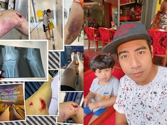 Đến thăm ba bị tai nạn, con trai Thanh Bình khiến mọi người 'tan chảy' với hành động này