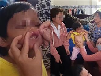 Tin MỚI vụ bé gái 4 tuổi ở Cà Mau bị cha nuôi bạo hành dã man: Khẩn trương bảo vệ khẩn cấp!