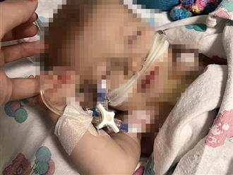 Thấy con 3 tháng tuổi ngủ nhiều, bố mẹ ngỡ 'dễ nuôi', ai ngờ đi khám phát hiện ở tim có 1 'lỗ thủng', cảnh báo bệnh hiếm gặp