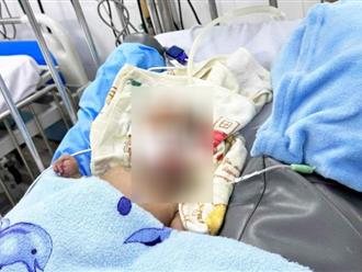 Bé trai 3 tháng tuổi tử vong nghi bị mẹ và bố dượng bạo hành: Từng nhập viện trong tình trạng biến dạng tay trái, xuất huyết não