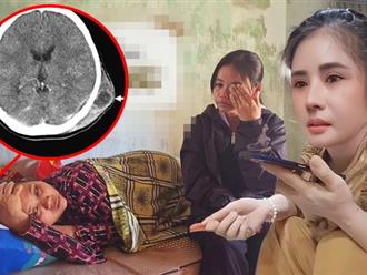 Mẹ nữ sinh lớp 9 'bom' hàng mắc căn bệnh 'lạ': Bác sĩ chỉ cách phòng tránh trước khi quá 'muộn'