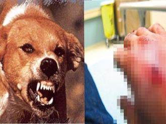Chó cắn nhưng không chịu chích ngừa, người đàn ông nghi bị dại, tấn công vợ: Tử vong sau 2 ngày phát bệnh