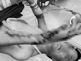 Sơ ý khi vận hành máy cưa nước đá, người đàn ông ở Đồng Nai bị nghiền dập nát tay, có nguy cơ tàn phế 