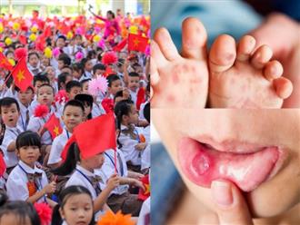 Cảnh báo nguy cơ lây lan bệnh tay chân miệng ở trẻ tăng cao trong bối cảnh bắt đầu năm học mới