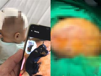 TP.HCM: Bé gái 6 tháng tuổi bị chó cắn xuyên sọ, người mẹ suy đoán 'thú cưng ghen tị vì không còn được gia đình quan tâm nhiều như trước'