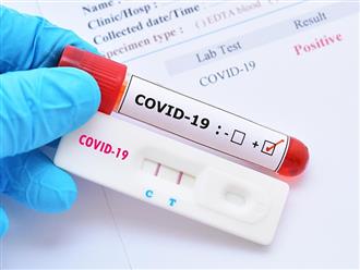 TP.HCM: Khuyến cáo người dân không nên mua bộ test nhanh COVID-19 trên mạng vì độ chính xác chỉ 25%