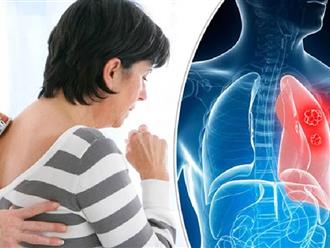 Coi chừng 4 triệu chứng bất thường này khi ngủ có thể là dấu hiệu của ung thư phổi