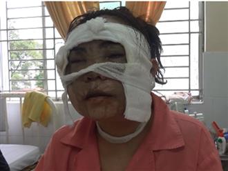 Cô gái trẻ bị tạt axit hủy hoại gương mặt, hỏng hai mắt chỉ vài ngày trước khi lên xe hoa