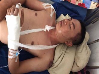 Đi đòi nợ, nam thanh niên ở Đắk Lắk bị đánh nhập viện