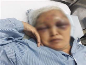 Hà Nội: Đến thăm con vào giữa đêm không được đồng ý, rể cũ ra tay đánh mẹ vợ nhập viện