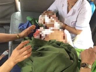 Lại thêm một bé trai 7 tuổi bị chó nhà nuôi cắn tử vong ở Thái Nguyên