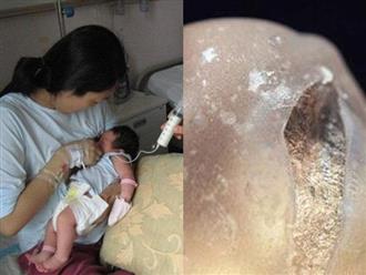 Người mẹ trẻ bị nổ túi ngực khi cho con bú: Chi hàng trăm triệu nhưng vẫn suýt mất mạng