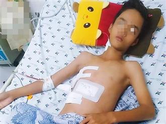 Tai nạn đau lòng: Đi làm mướn nuôi cha tâm thần, bé trai 13 tuổi bị thanh sắt máy cắt lúa đâm xuyên thấu ngực