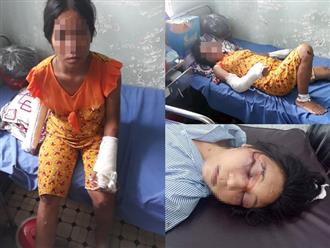 Vợ bầu 7 tháng bị chồng hờ đánh gãy tay chân, vỡ sọ ở Bình Thuận: Bị bạo hành hơn 1 năm qua