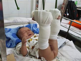 Đau lòng: Bé trai 4 tháng tuổi ở Sài Gòn nghi bị cha ruột đánh gãy chân, xuất huyết não để ‘dạy dỗ’