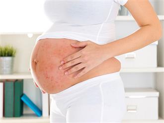 Mang thai 35 tuần bị ngứa có nên dùng thuốc không?
