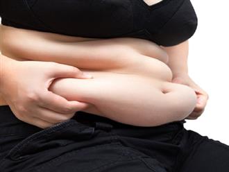 Vòng bụng càng to, vòng đời càng ngắn: 5 căn bệnh nguy hiểm tấn công người có mỡ bụng