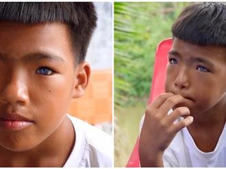 Cậu bé có đôi mắt xanh biếc nhưng mang số phận nghiệt ngã: Lớp 2 đã phải nghỉ học, từng bị giật 30 tờ vé số vì mắt kém