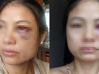Xót xa câu nói của người vợ bị chồng đánh đến mức nhập viện ở Đồng Nai: 'Có tuần bị đánh tới 3 lần'