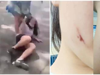 Phát hiện một nữ sinh bị đánh trầy trật và đe dọa trong phòng nội trú: gia đình bất ngờ vì trường không tố cáo