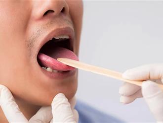 5 dấu hiệu ở lưỡi cảnh báo loạt bệnh ung thư, đột quỵ nguy hiểm
