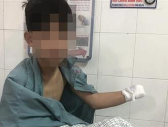 Tai nạn nghiêm trọng do nghịch pháo tự chế: Nhiều thiếu niên đã phải cắt cụt bàn tay